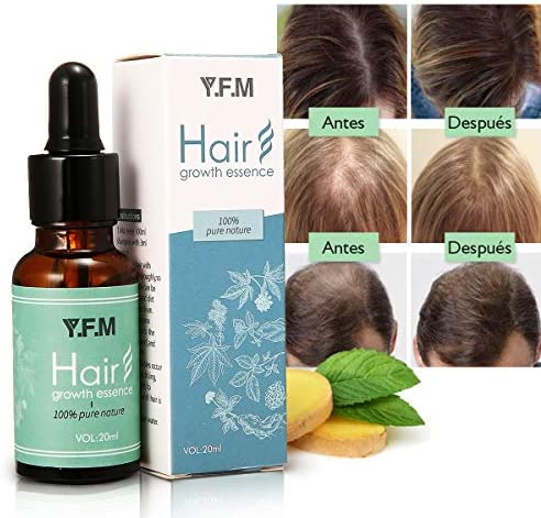 Hair Growth Essence Y.F.M. olio per capelli per la crescita dei capelli,...